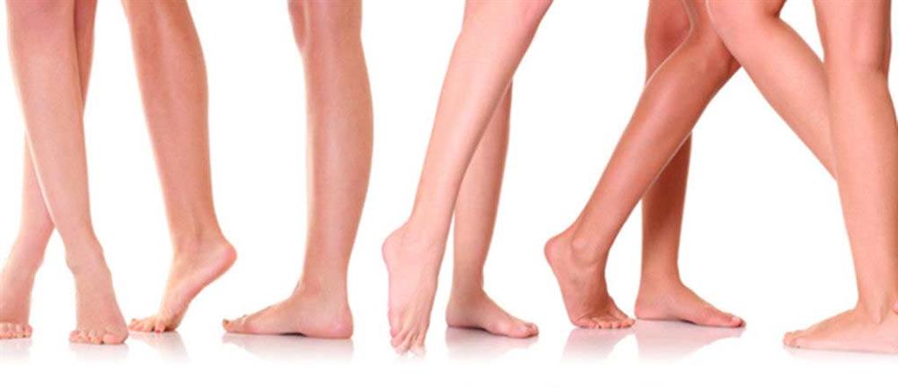 laser hair removal
