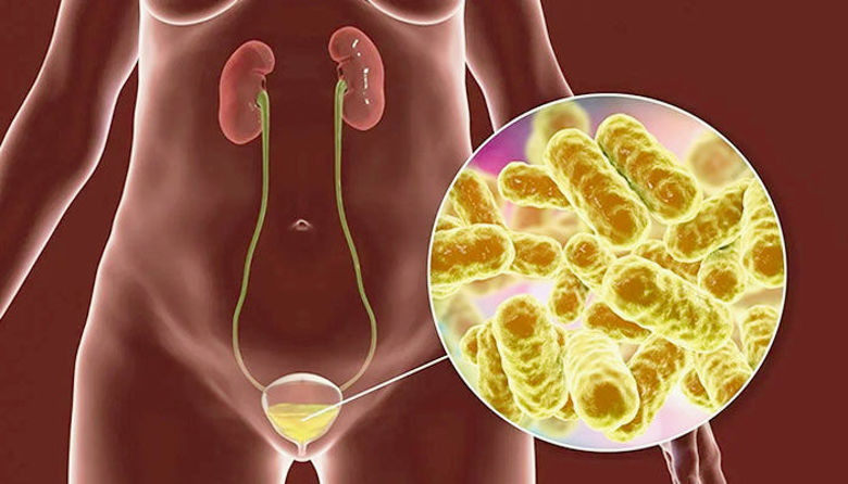 Picture ofKateri antibiotik za vnetje mehurja