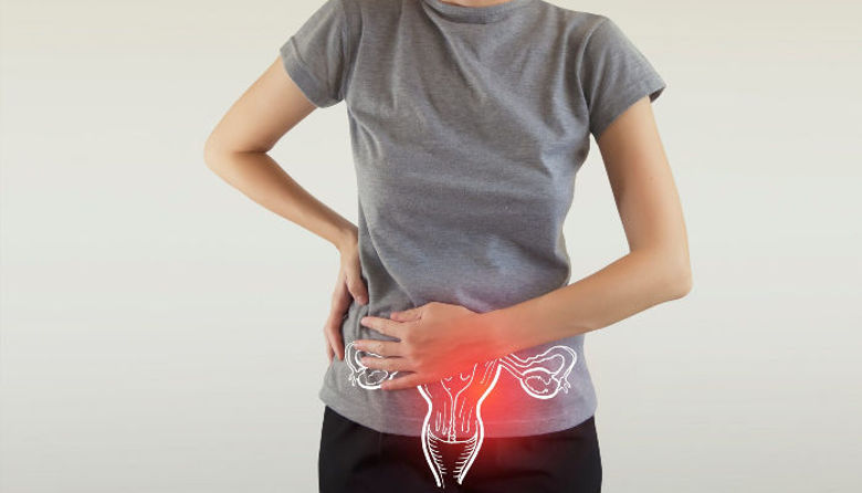 Picture ofEndometrij